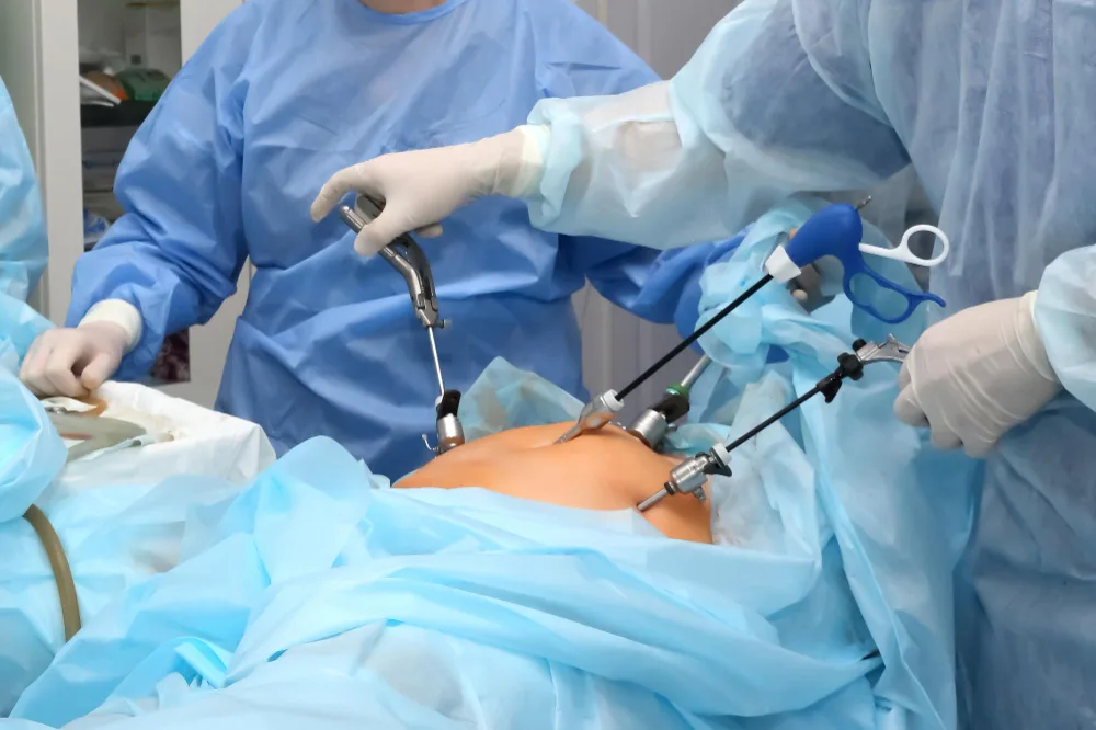 Laparoscopia Urológica en CDMX